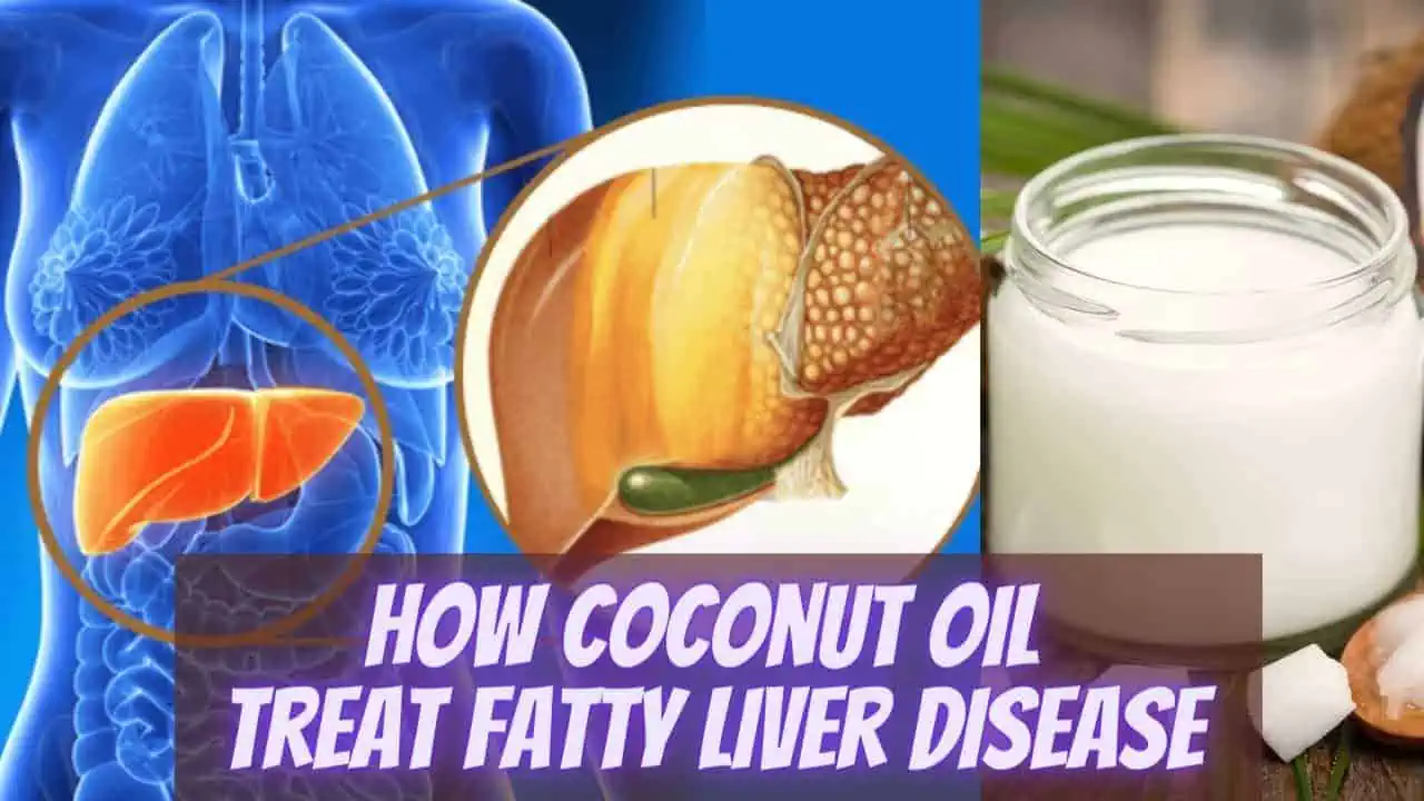 fatty liver disease