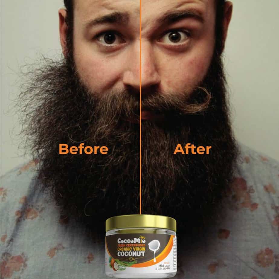 Is Coconut Oil Good For Beard